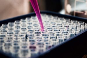 Home Diagnostic Lab Case Gallery 3 300x200 1