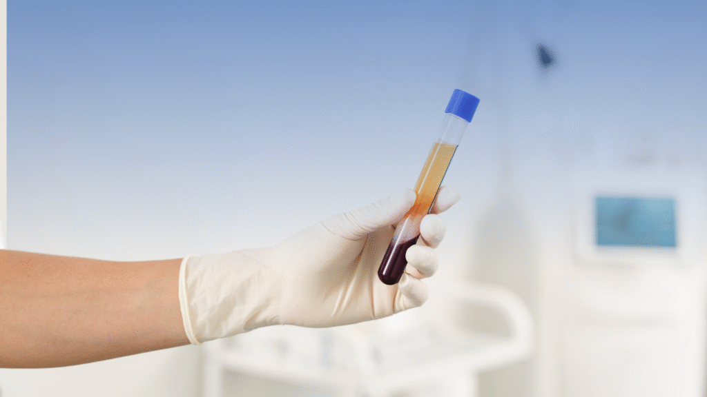 PRP infiltration versus corticosteroids: a preliminary randomized clinical trial